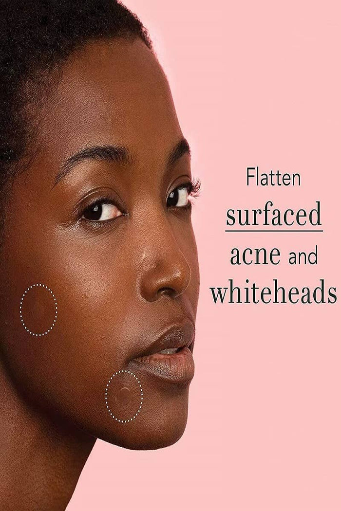 The Original Hydrocolloid Acne Pimple Patch-Box of 36